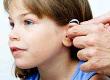 What Types of Congenital Hearing Problems Are There?