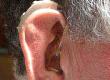 Ear Health in the Over 75s