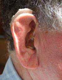 Hearing Problems Hearing Aid Hearing