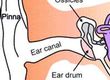 Do you Have a Ruptured Eardrum?