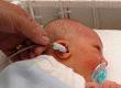 Hearing Problems in Children Due to CMV Infection