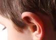 Prominent Ears: How They Can Affect Children