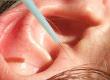 What is Auricular (ear) Acupuncture