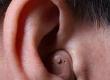 What Causes Deafness?
