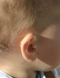 Have I Damaged My Child's Ears?