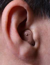Deafness; Hard Of Hearing; Hearing