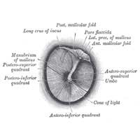 Myringoplasty; Ear Drum; Perforation;